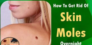 How to Get Rid of Moles at Home how to get rid of moles