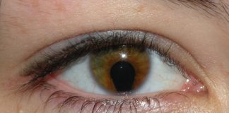 Broken Blood Vessel In Eye What Should Do broken blood vessel in eye