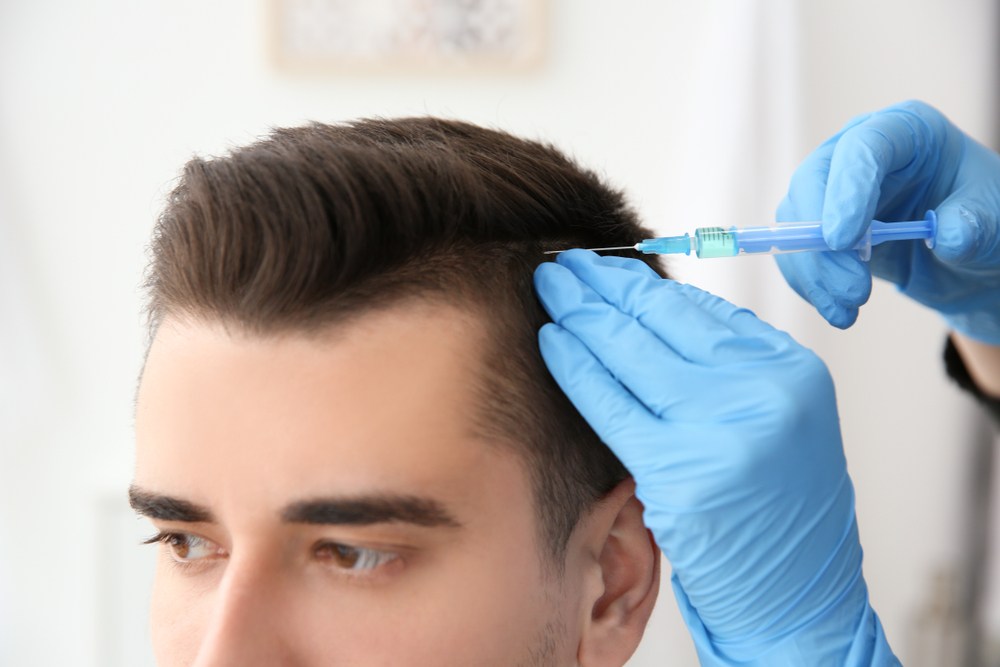 Cosmeticium in Turkey is the Best Place for Hair Transplant