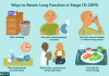 What are the 4 stages of COPD briefly discussing what are the 4 stages of copd