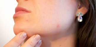 7 Natural Remedies For Irritated Skin Natural Remedies For Irritated Skin